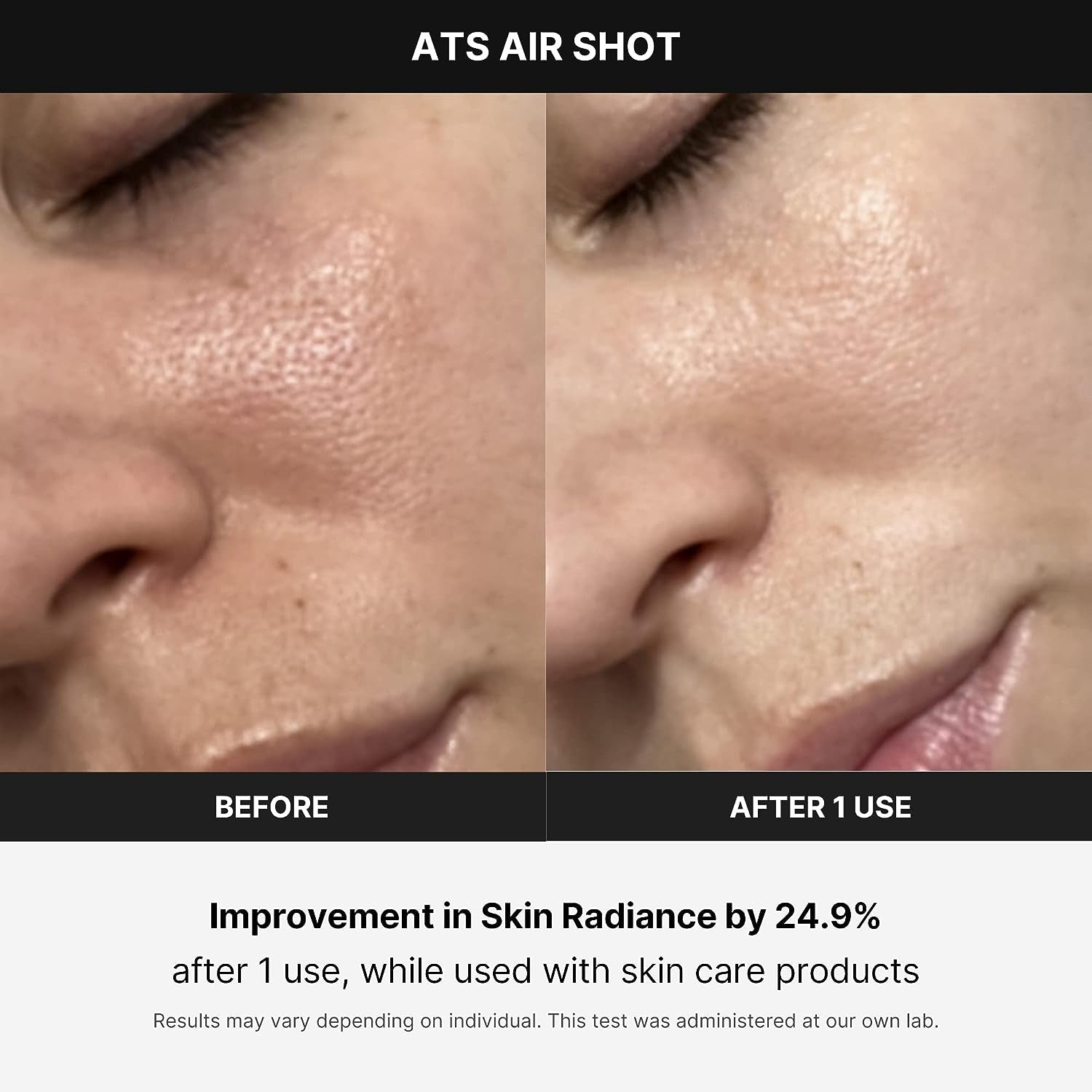 Transform Your Skin with the Age-R ATS Air Shot - The Ultimate Microneedling Pore Tightening Device for Exquisite Absorption, Refined Pores, and Silky Smooth Texture!