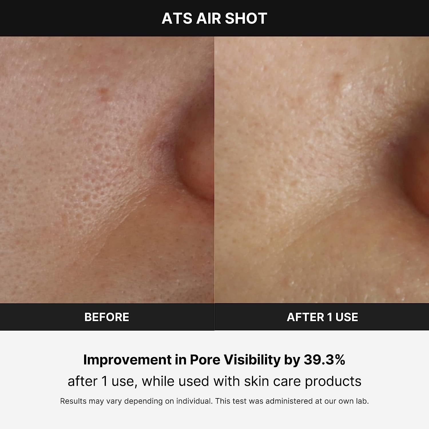 Transform Your Skin with the Age-R ATS Air Shot - The Ultimate Microneedling Pore Tightening Device for Exquisite Absorption, Refined Pores, and Silky Smooth Texture!