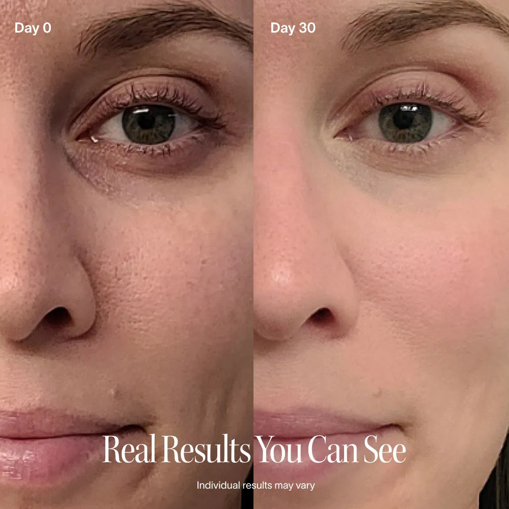 4-In-1 Radiant Renewal Skincare Wand with Red Light Therapy